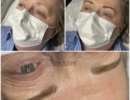 Lisa Ritchie Bespoke Permanent Makeup