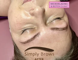 Simply Brows Microblading & Aesthetics Warwick