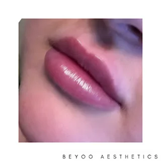 Photo Beyoo Aesthetics, Skin and Wellbeing