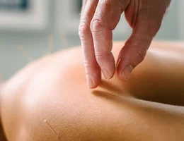 Catherine Stone Acupuncture and Massage