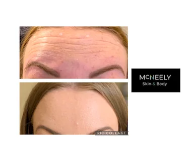 Photo McNeely Skin and body- Aesthetics and Skincare