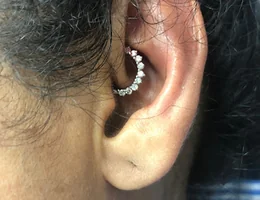 Daith Piercing for Migraine Harley Street London